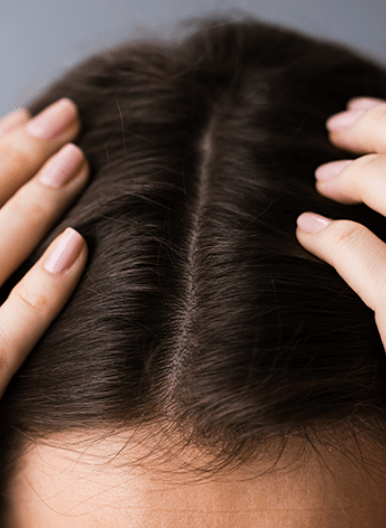 Scalp Care: 5 Steps for a Healthy Scalp - Keeo Hair