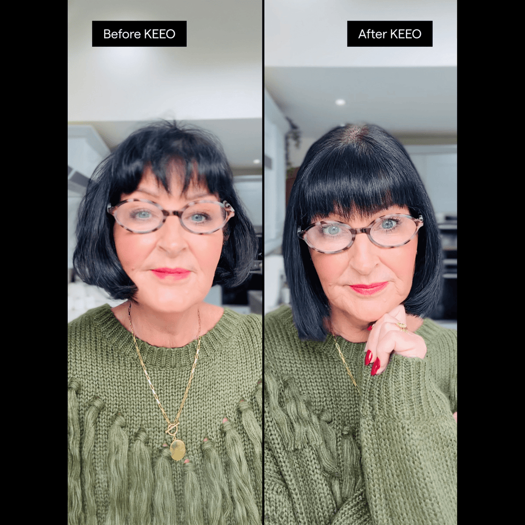 Side-by-side comparison of a woman wearing glasses labeled 'Before KEEO' and 'After KEEO'.